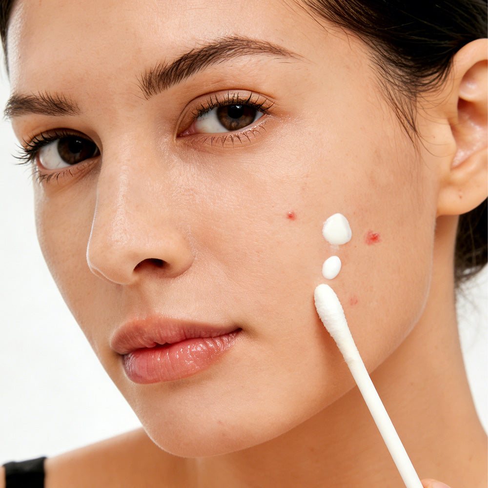 Lozione viso con acido salicilico, niacinamide, zolfo e ossido di zinco