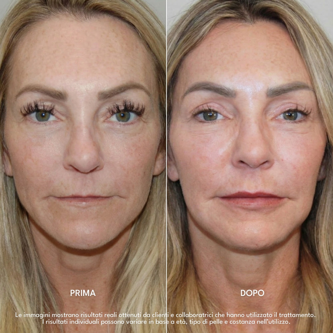 Luvish | LipFusion Precision Kit