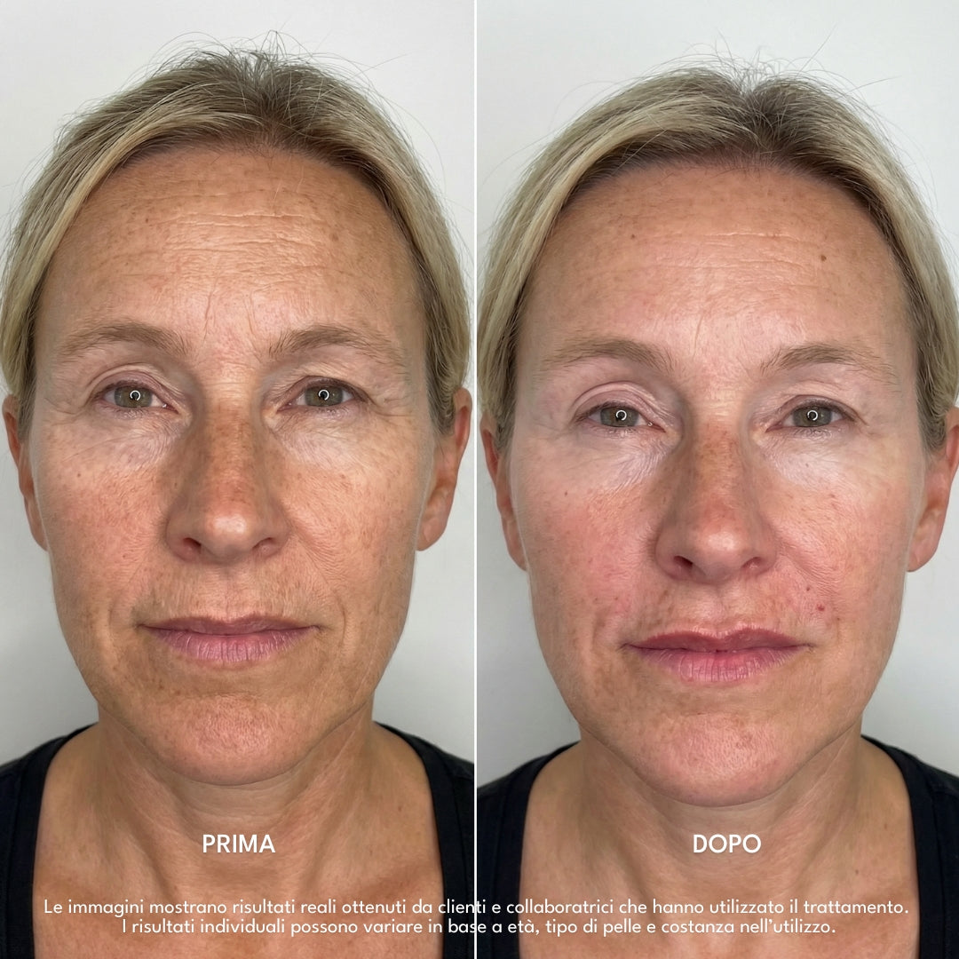 Luvish | LipFusion Precision Kit