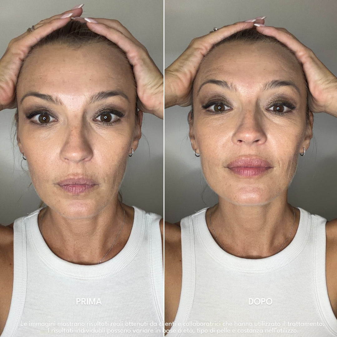 Luvish | LipFusion Precision Kit