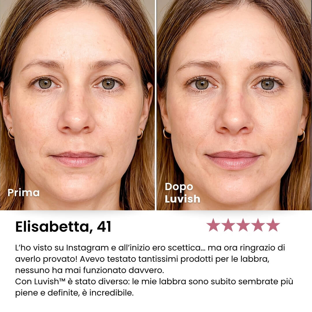 Luvish™ Lip Kit Luvia