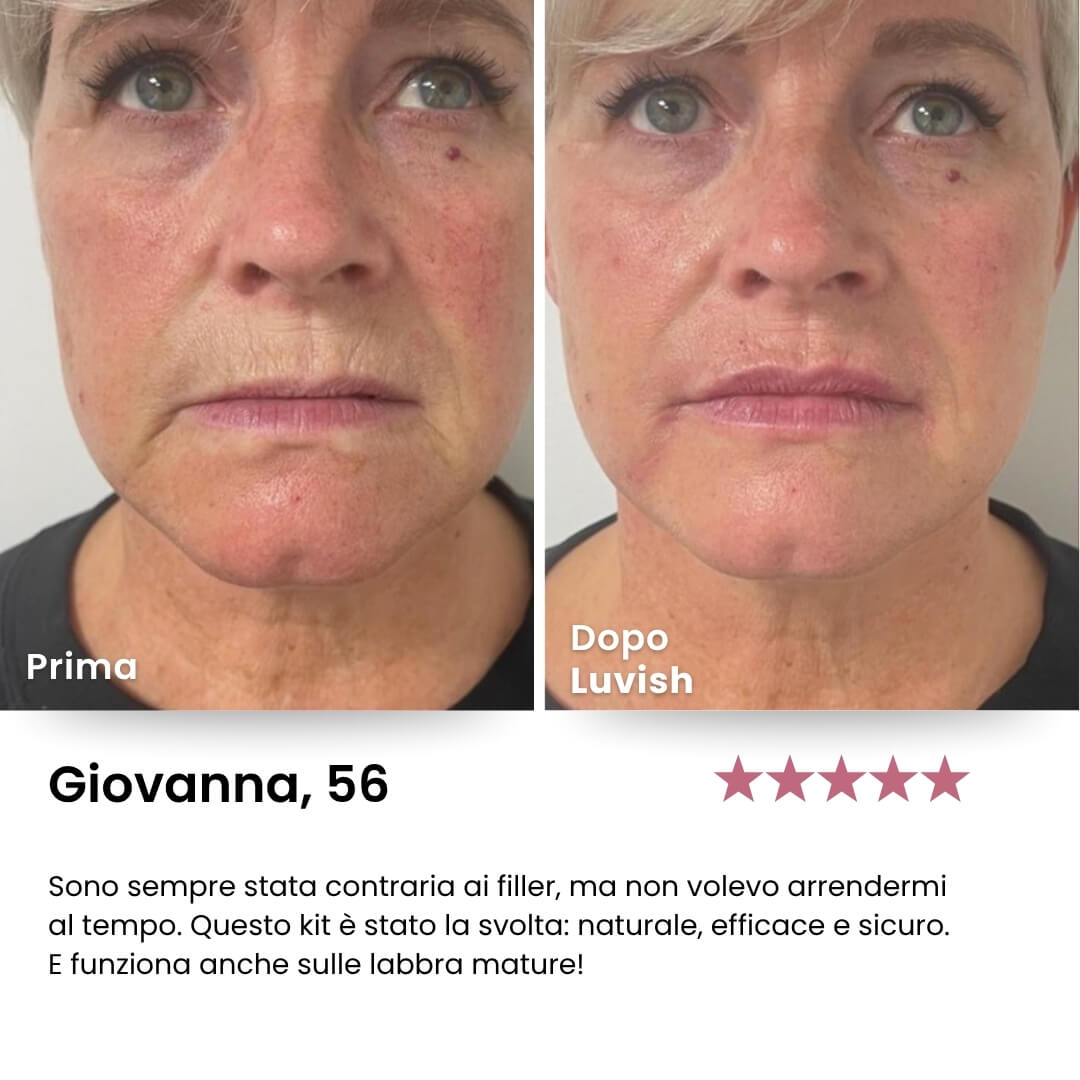 Luvish™ Lip Kit Luvia