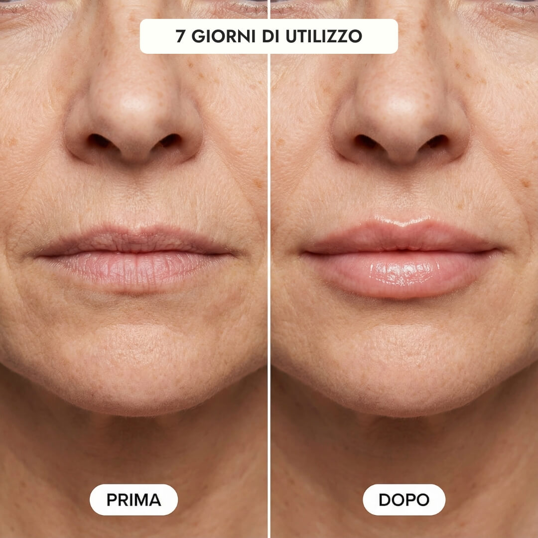 Luvish™ Lip Kit Luvia