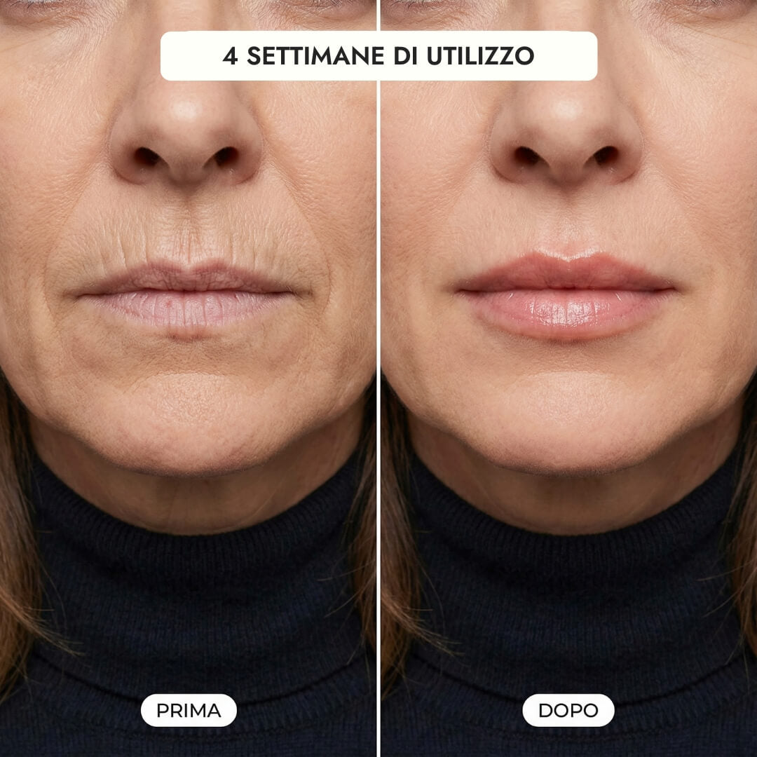 Luvish™ Lip Kit Luvia