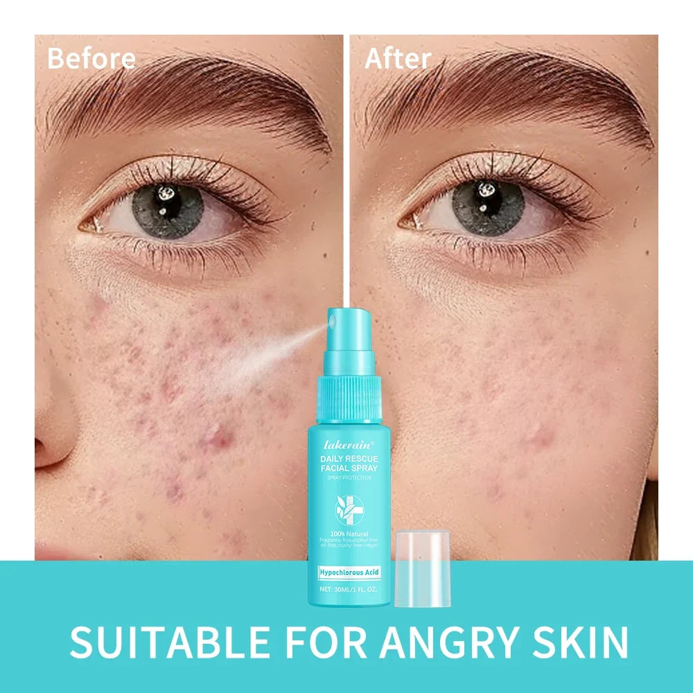 Dettaglio del flacone di tonico viso spray da 30 ml