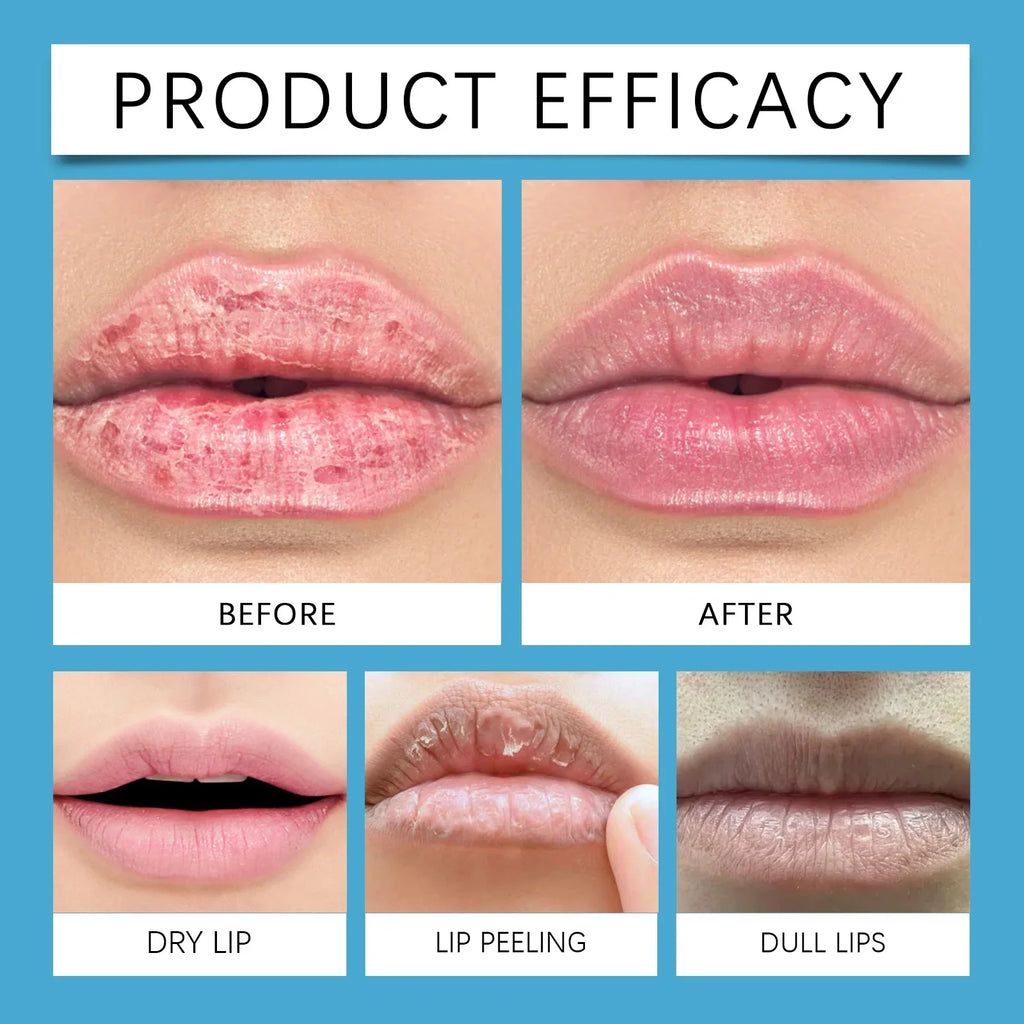 Flacone di siero labbra lip plumper con applicatore