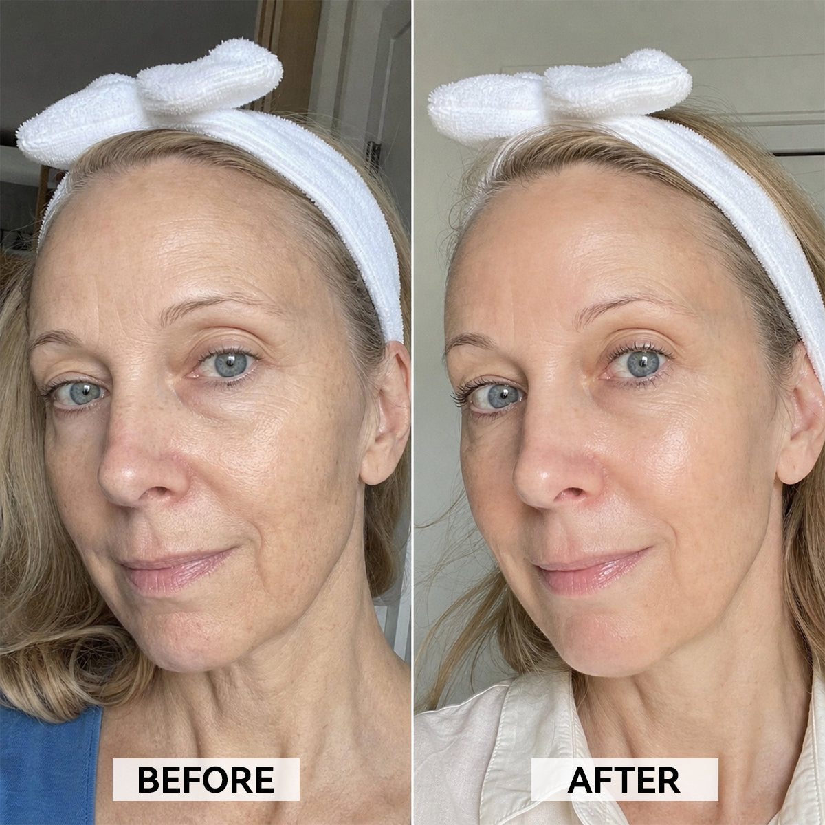 Texture leggera del siero viso PDRN applicata sulla pelle